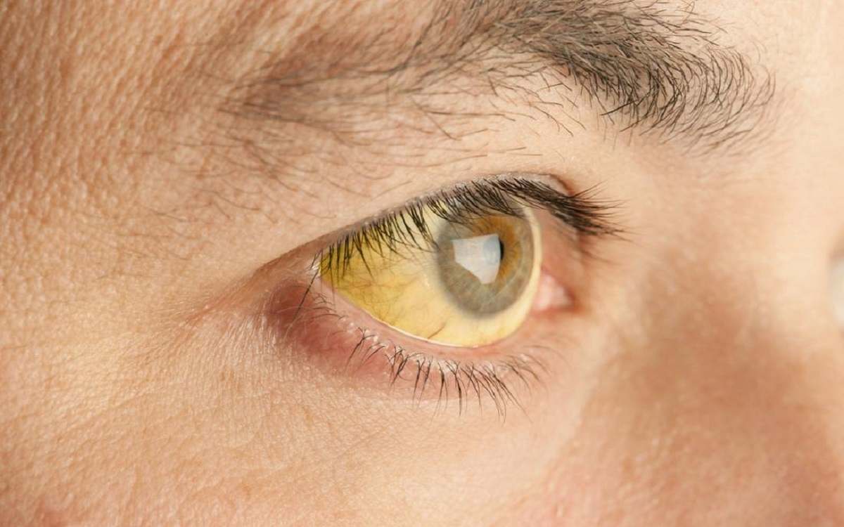 როგორ არის დაკავშირებული ადამიანის თვალის ფერი მის ჯანმრთელობასთან
